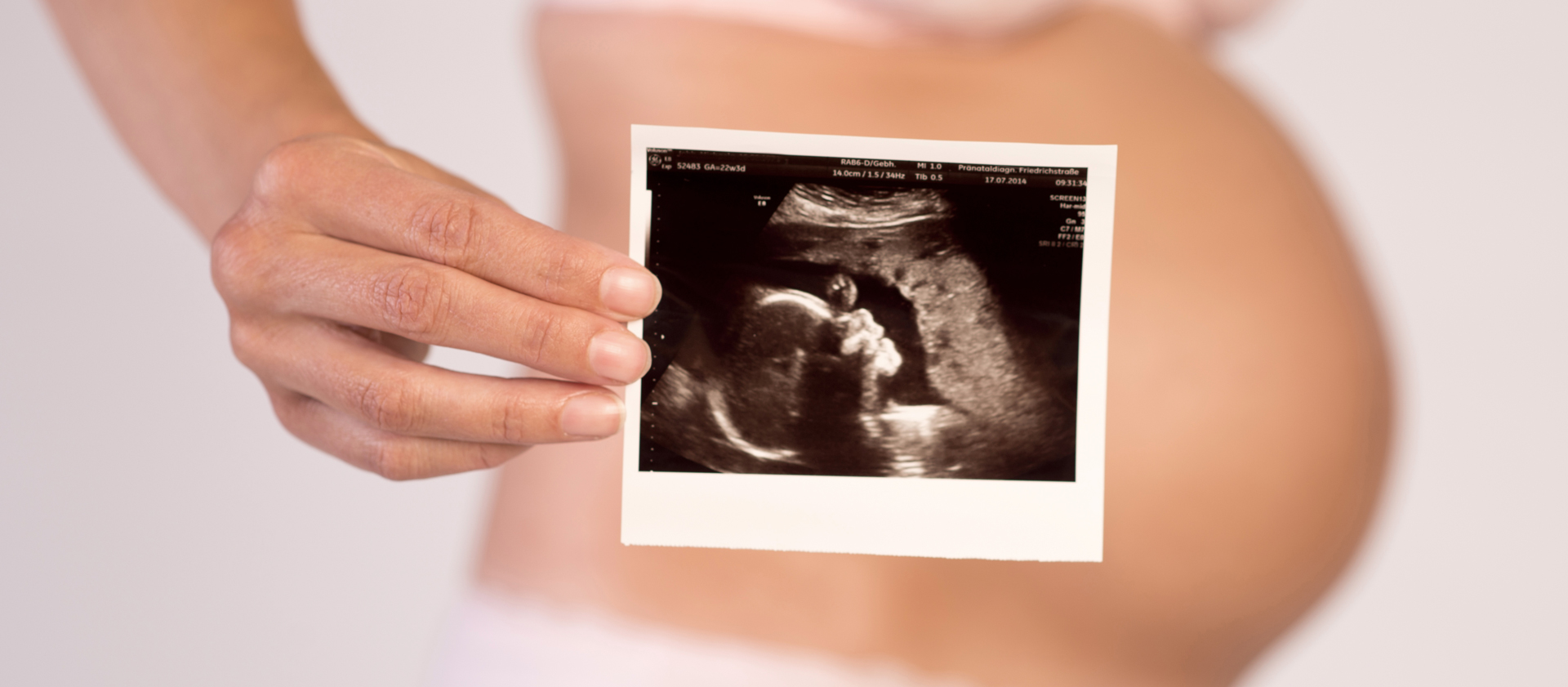 Eine schwangere Frau hält das Ultraschallbild ihres Babys in die Kamera